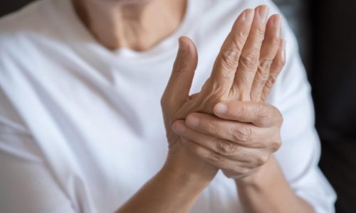 Arthritis Inflammation