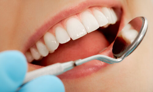 Maintaining Oral Health as Adults in Indianapolis: Tips and Tricks