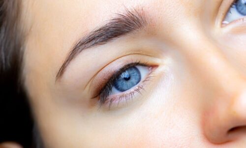 Double Eyelid Surgery: Important Tips To Remember